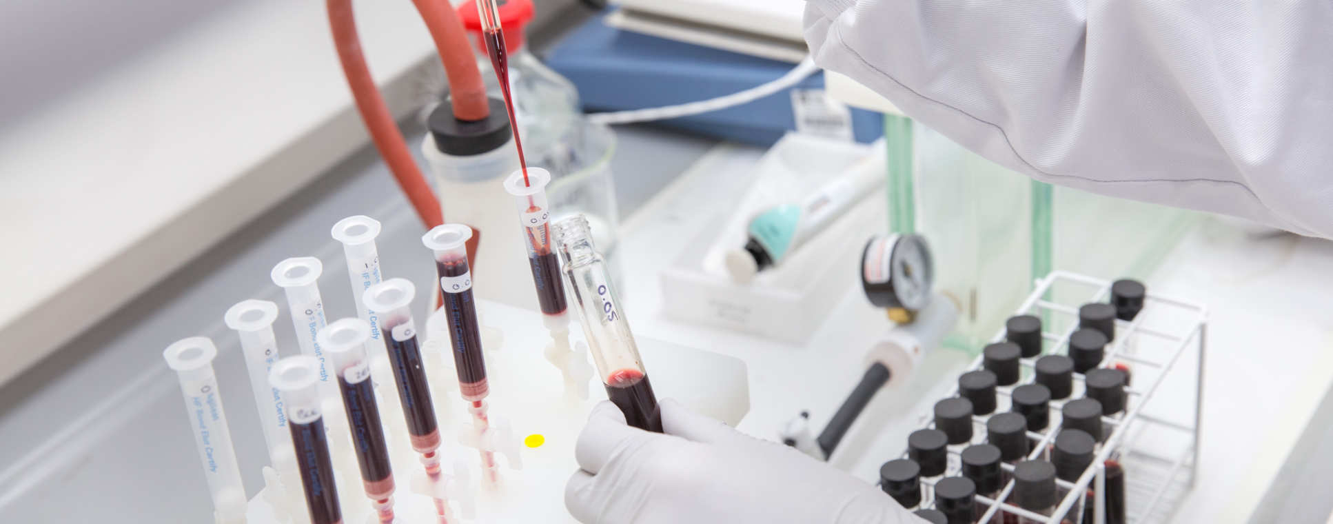 Antimicrobial resistance