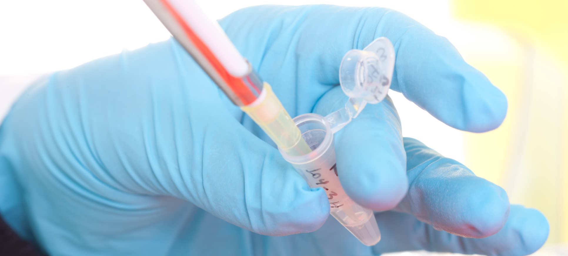 Pipette