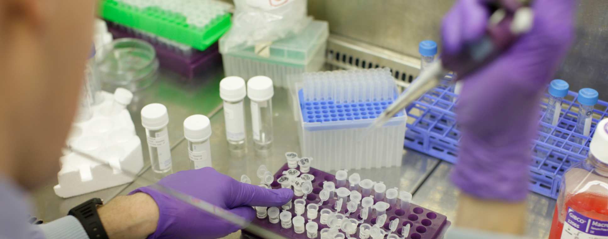 Centre for Complement and Inflammation Research