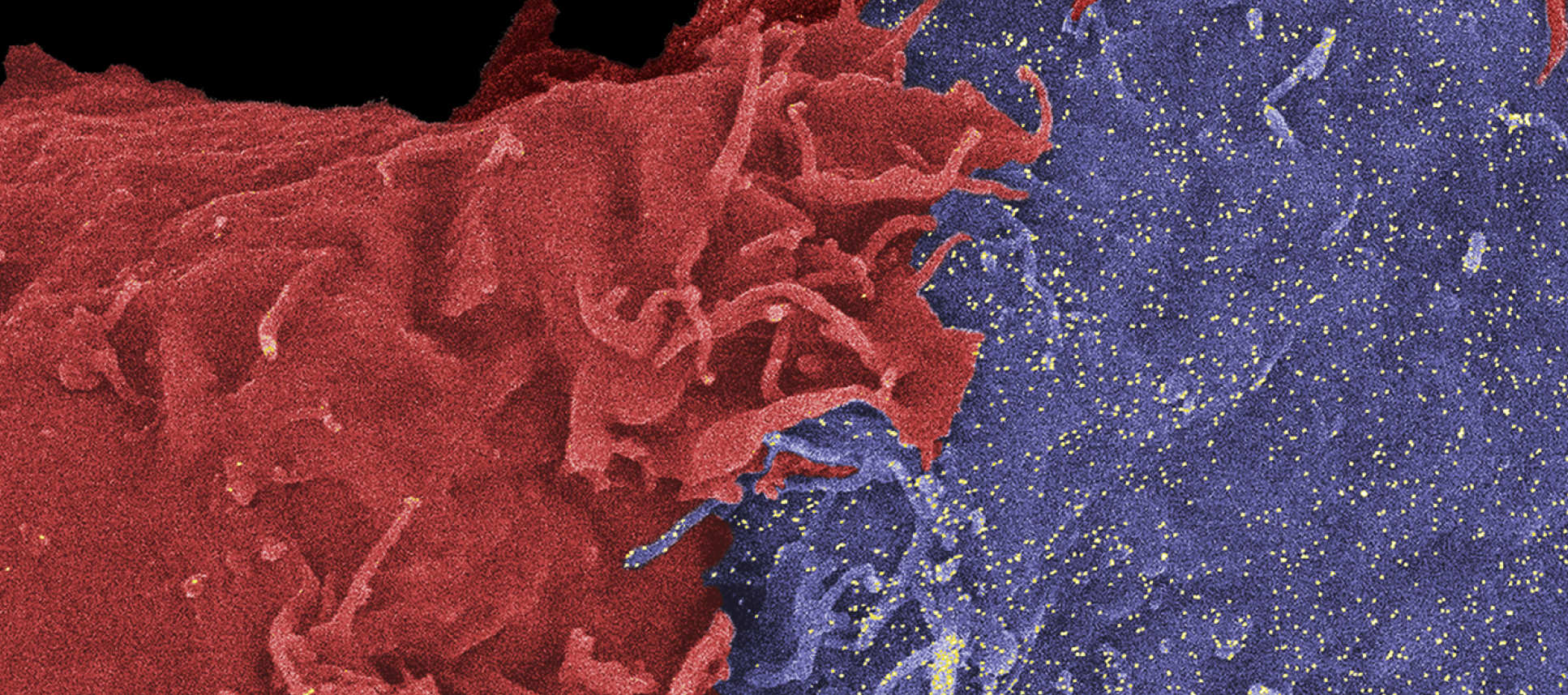 Cancer cells