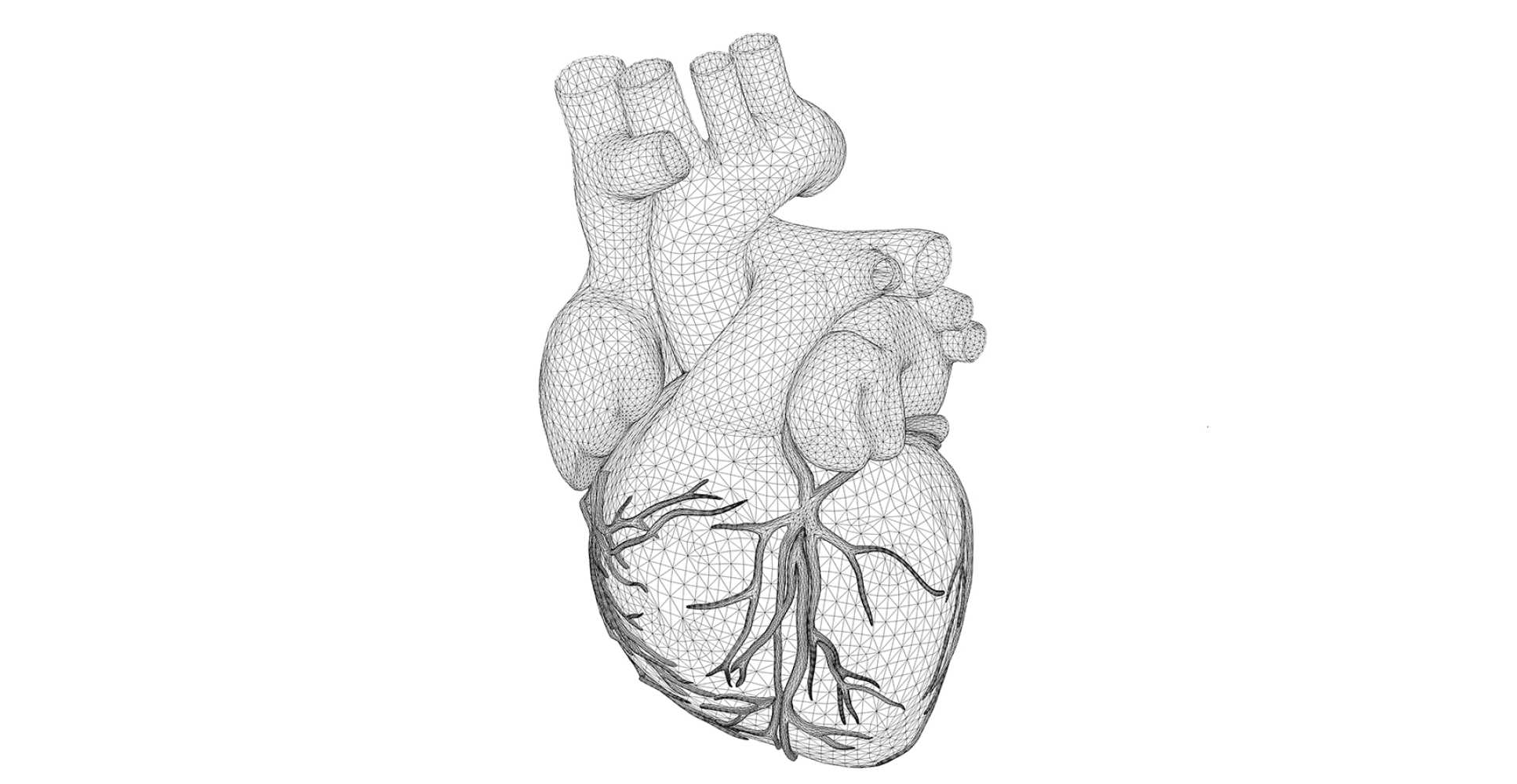 heart diagram