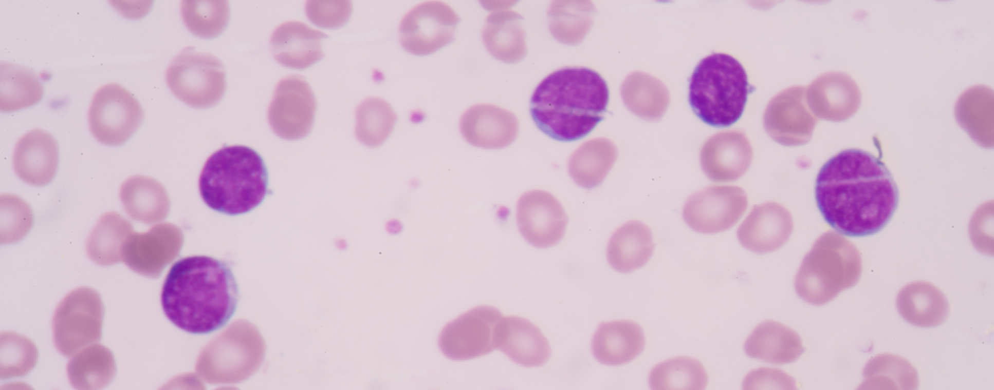 Haemato-oncology