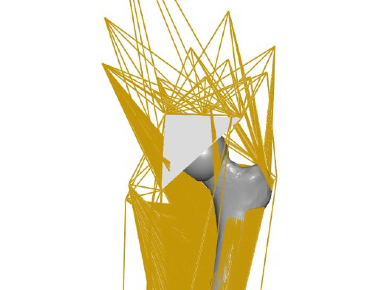 Free boundary condition model of the femur
