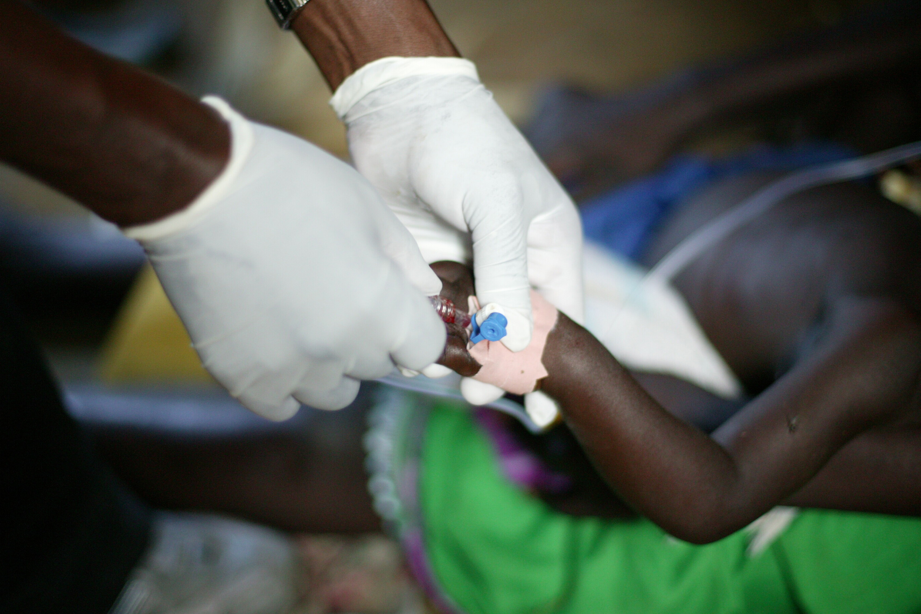 Photo of a child with cannula in its arm